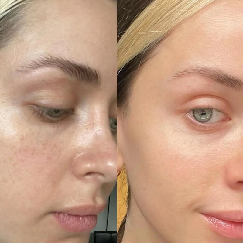 Nuvio Vegan PDRN Capsule Cream